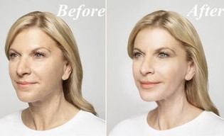 Antes y después de usar la Goji Crema