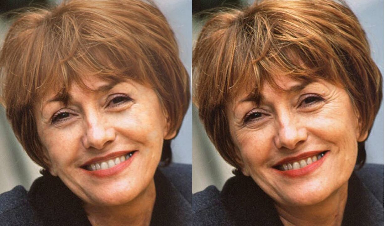 Foto del rostro antes y después del contorno. 